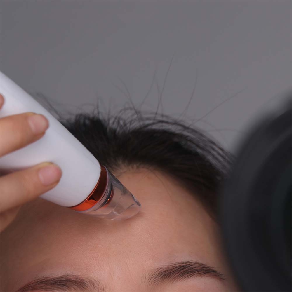 6-in-1 Electric Blackhead Remover Vacuum with LED Display