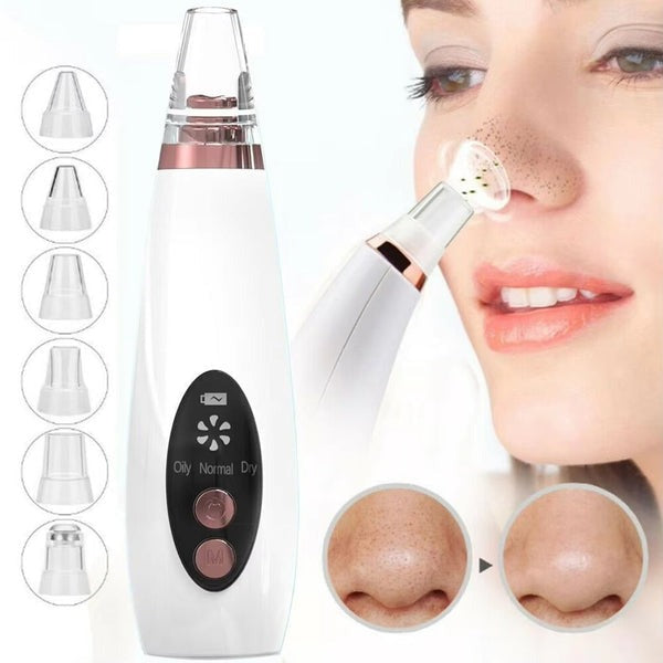 6-in-1 Electric Blackhead Remover Vacuum with LED Display